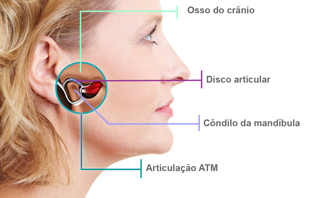 Você tem #bruxismo ? #dor na #mandibula ? Faça esse #exercicios para m