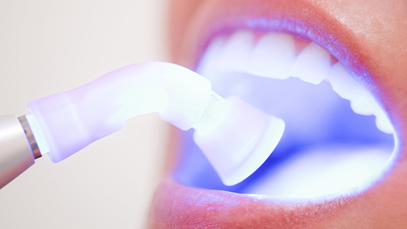 clareamento dental a led