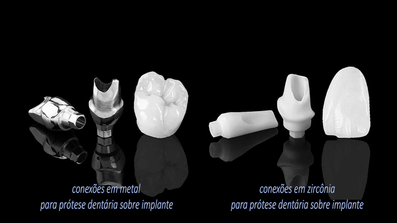 prótese dentária em zircônia conexões para implante
