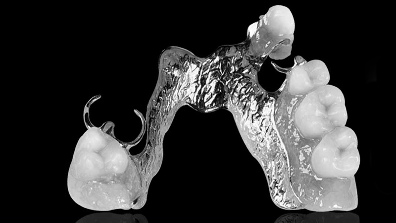 prótese dentária flexível metal