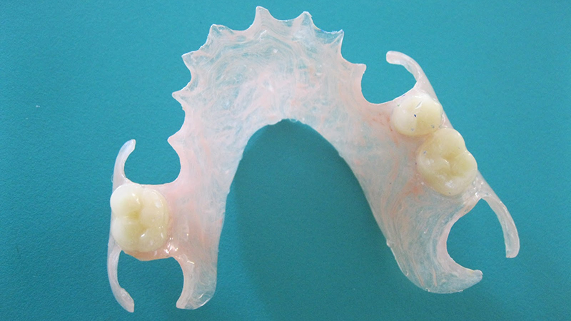 prótese dentária flexível post