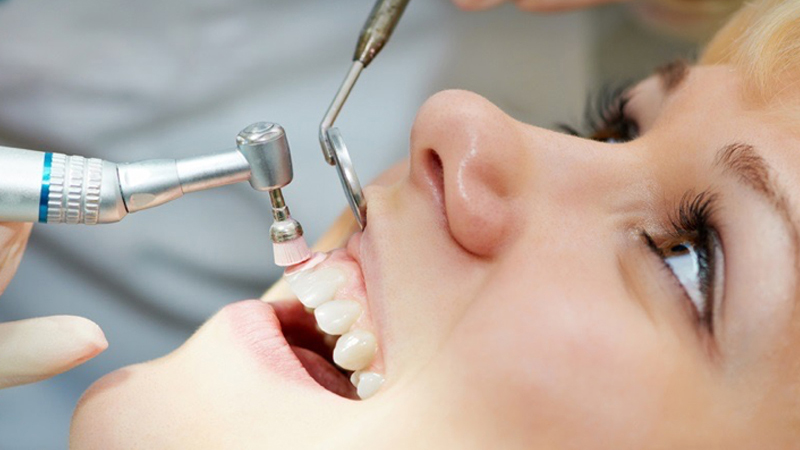 claremento dental e lente de contato dental peeling