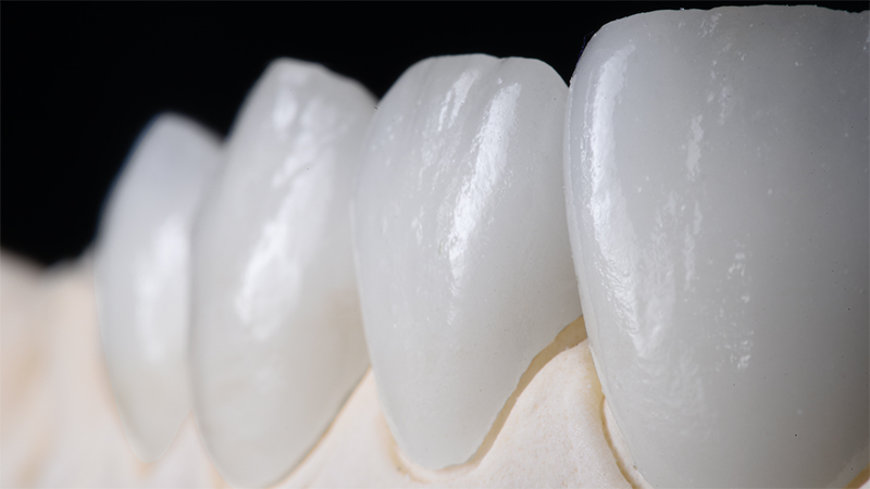 prótese dentária em porcelana pura