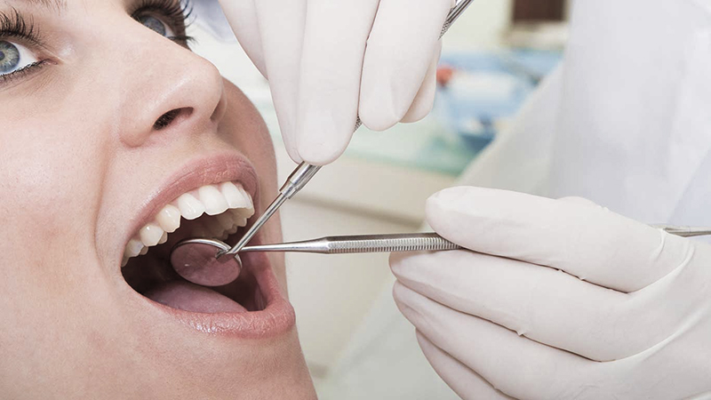 restauração dental em porcelana 7 vantagens post blog
