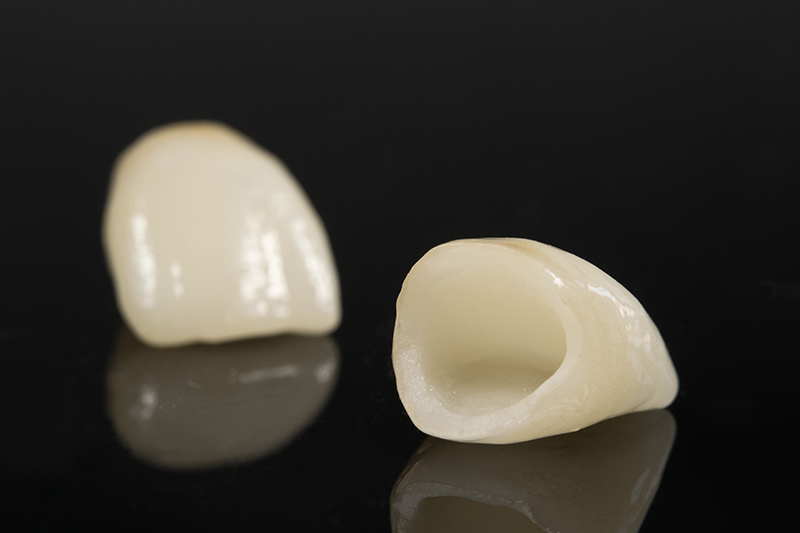 trocar prótese dental em porcelana pura