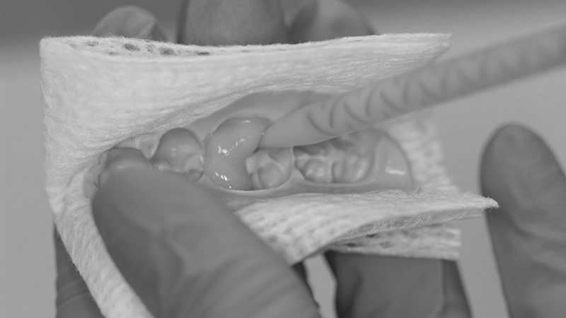 dentista confecciona dente provisório acrílico