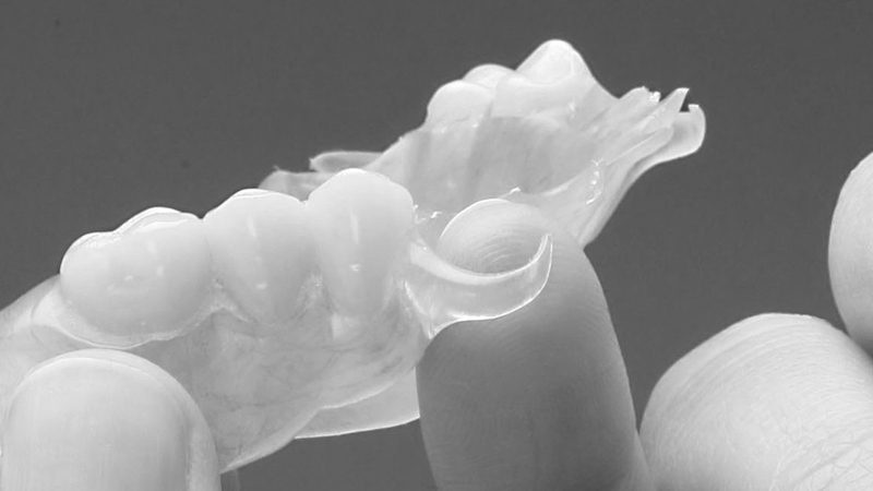 prótese dentária provisória flexível