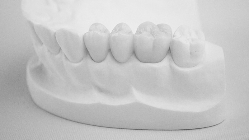 prótese dentária provisória trocar