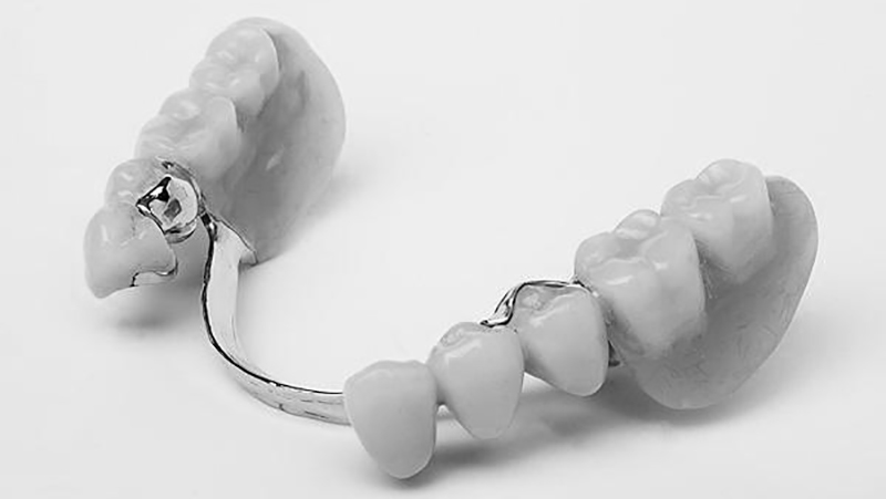 protese dentaria movel com encaixe