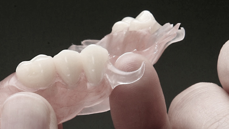 prótese-dentária-com-grampo-invisível-ou-estético
