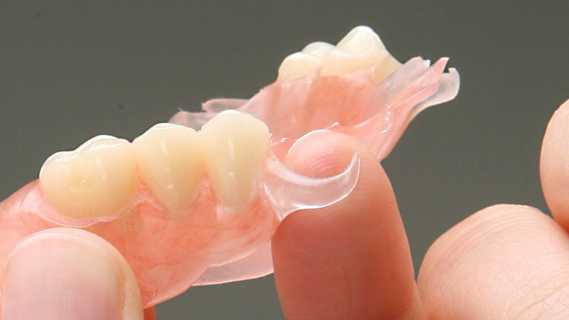 prótese dentária com grampo invisível ou estético