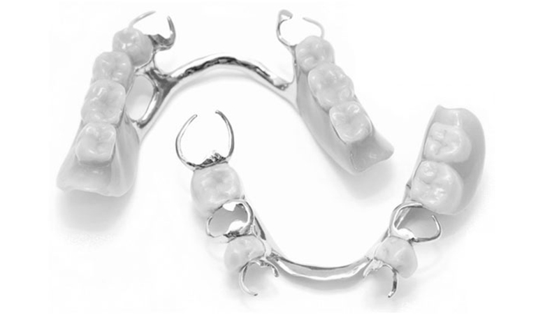 prótese dentária removível com grampo em metal