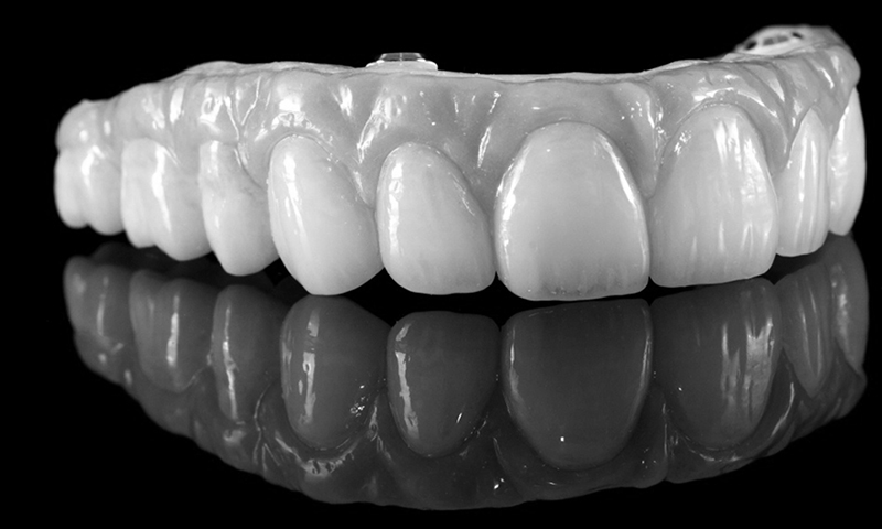 dentadura fixa em porcelana e zircônia