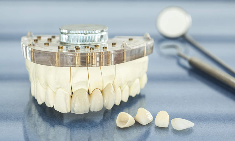 preço da prótese dentária fixa em porcelana