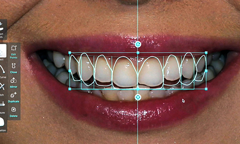simulação dental segurança em estética dental