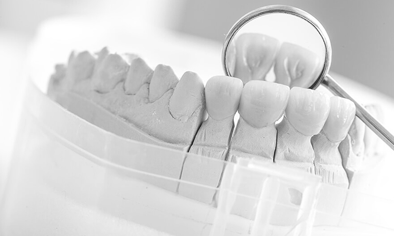 prótese dentaria fixa em porcelana dentes anteriores incisivos