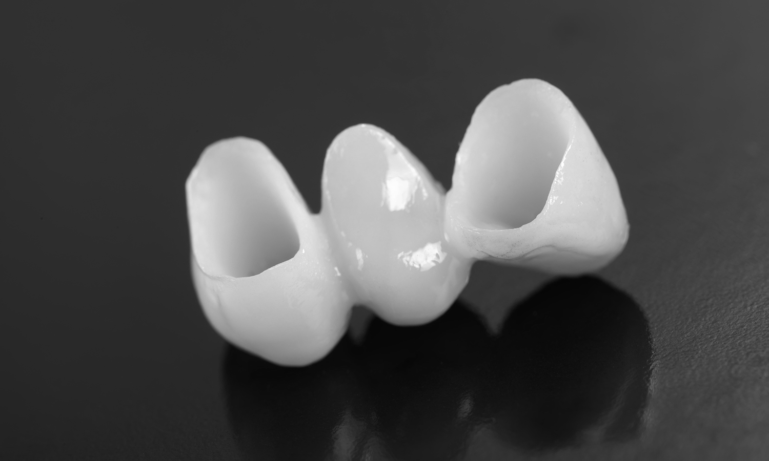 prótese dentária em porcelana vista interna do pôntico