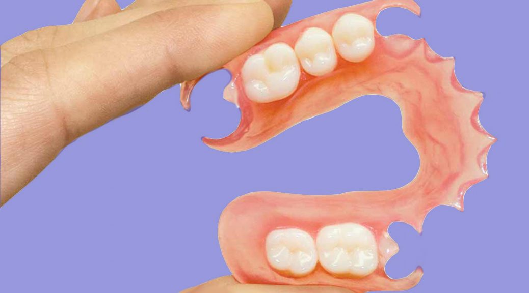 prótese dentária flexivel durabilidade prós e contras post blog