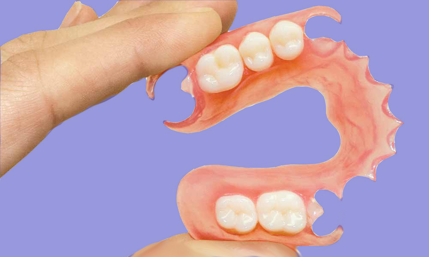 Prótese dentária flexível durabilidade, prós e contras.