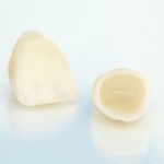 Prótese dentária fixa: melhor material e técnica explicados.