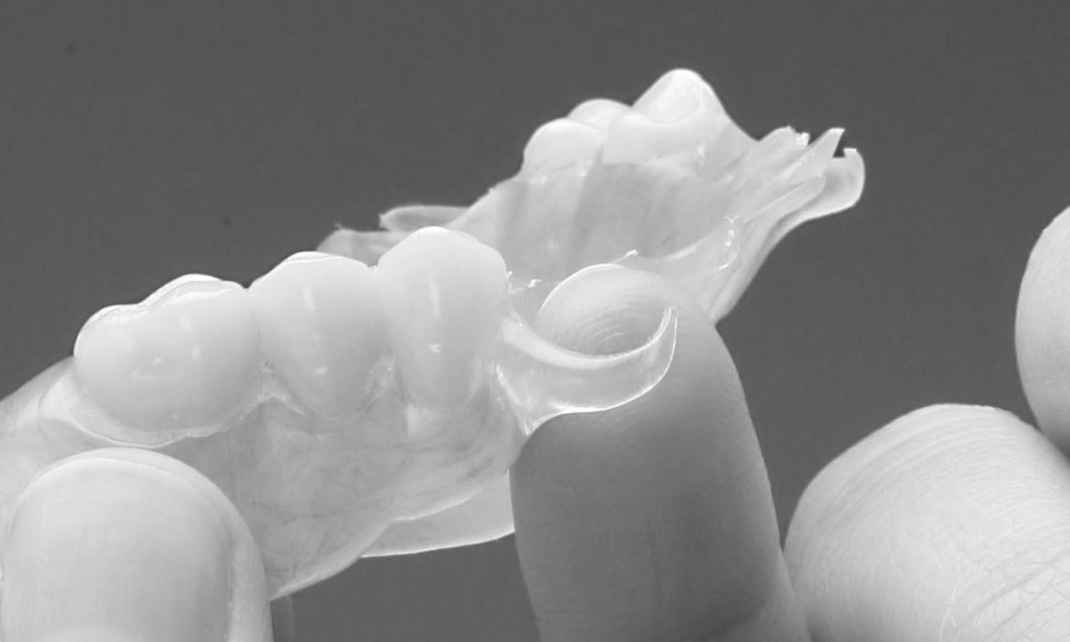 prótese dentária com grampo estético ou invisível