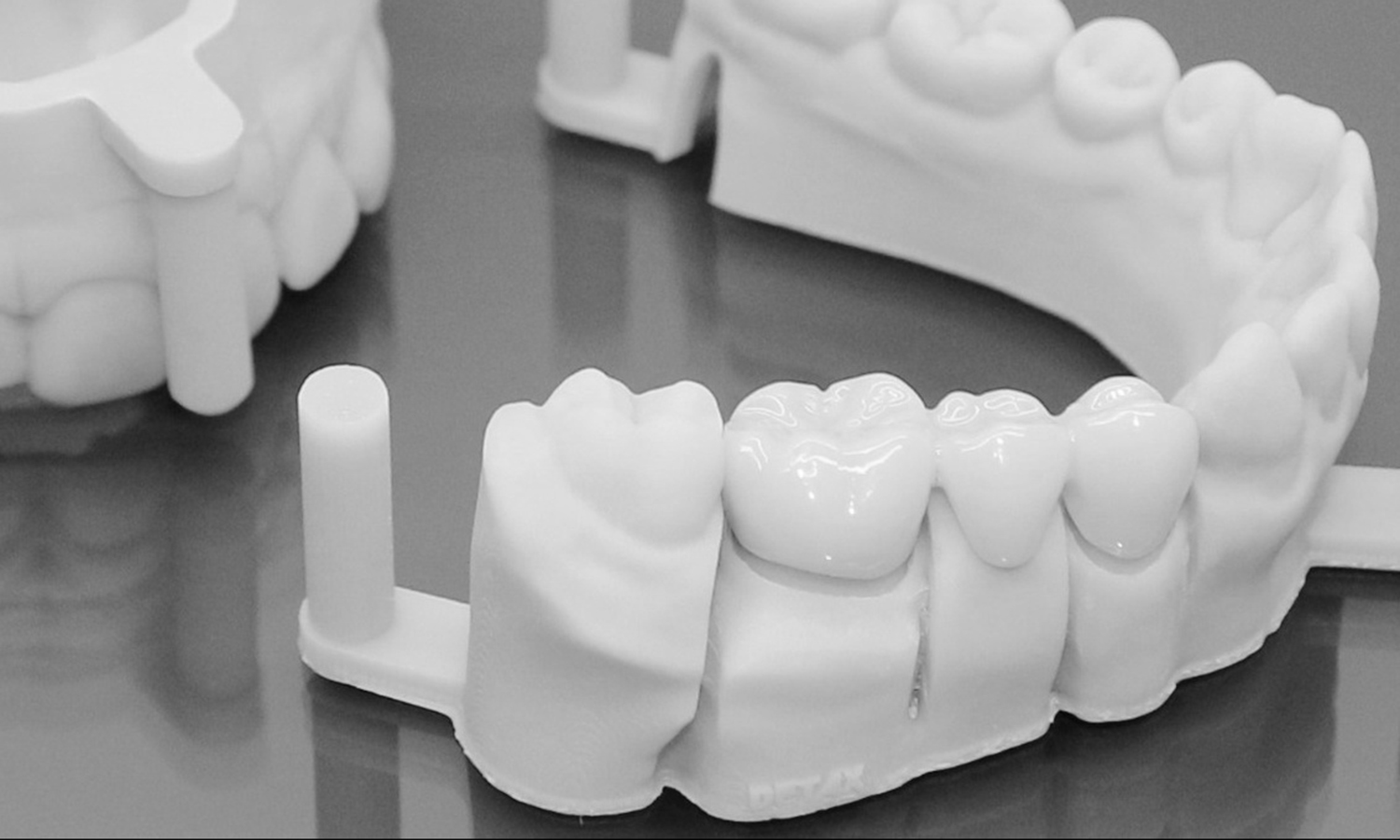 prótese dentária fixa em porcelana pôntico