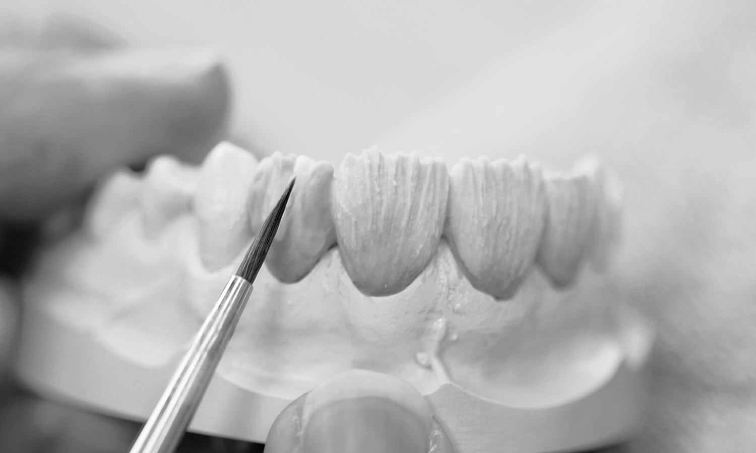 prótese dentária fixa em porcelana