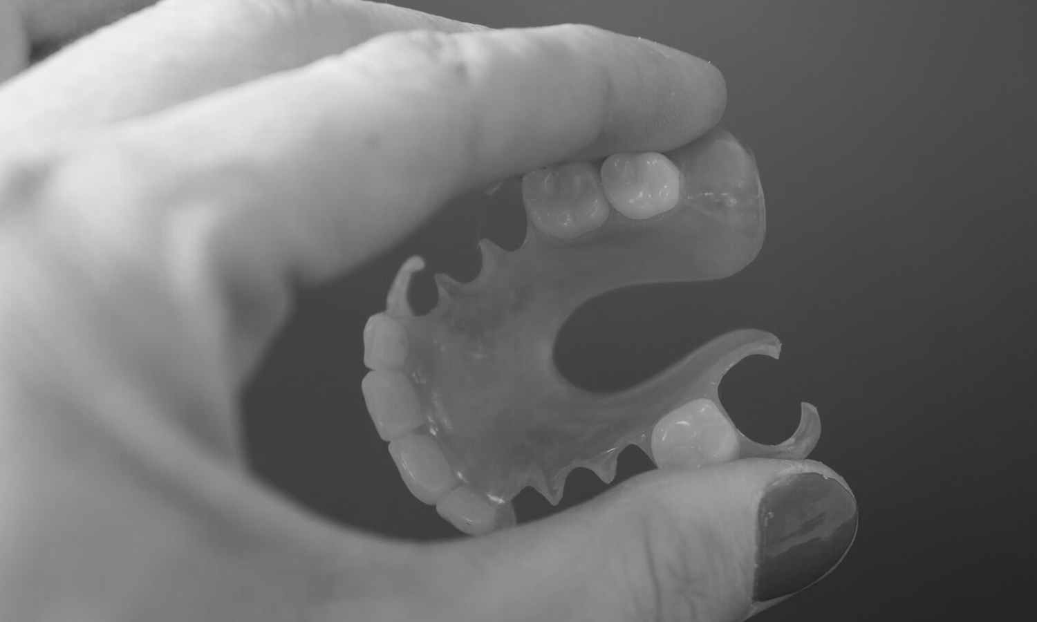 prótese dentária flexível indicações prós e contras