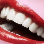 Estética gengival: próteses dentárias exigem gengivas alinhadas.