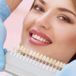 Os melhores tipos de próteses dentárias para você acertar no sorriso.