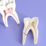 Fratura em raiz dentária: implante não é a única solução.