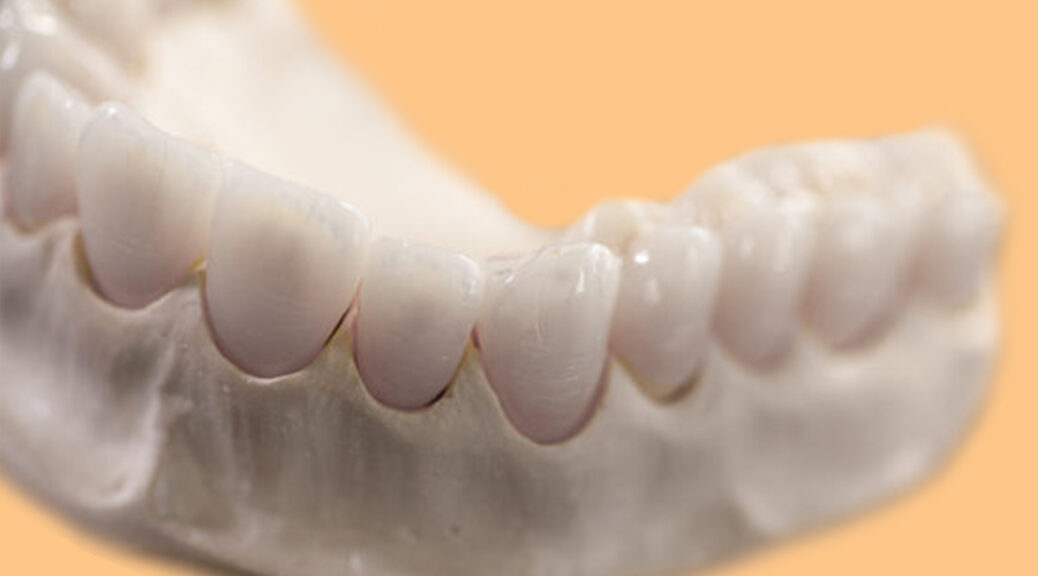 protese dentaria fixa porcelana e zircônia materiais blog