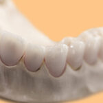 Prótese dentária: da porcelana à zircônia, escolha o material e o tipo ideal.
