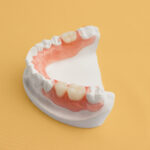Prótese dentária de silicone: durabilidade e mastigação exigem atenção.