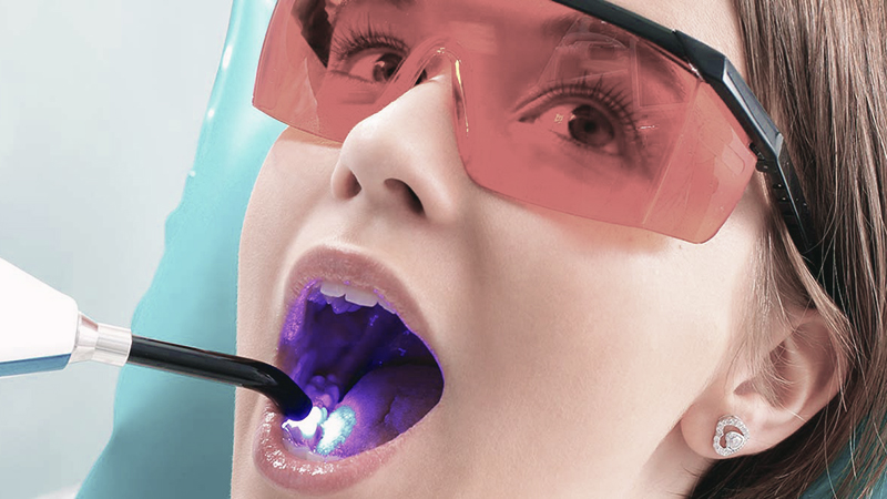 clareamento dental a laser post blog