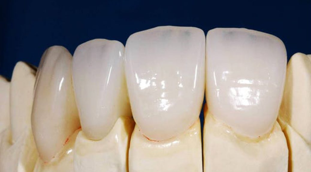 protese dentaria em porcelana pura e zircônia diferença