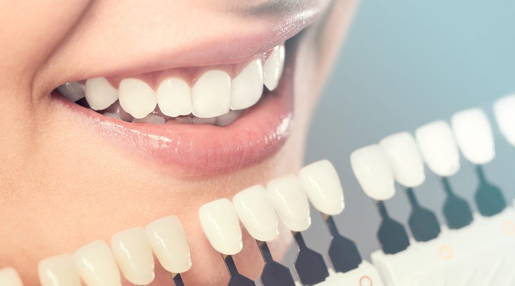 prótese dentária em zircônia dente escuro ou escurecido tratamento de canal post blog