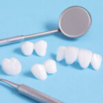 Prótese dentária em zircônia: o que é e quando deve ser utilizada.