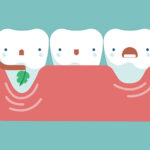 Dor e sensibilidade nos dentes: retração gengival pode ser a causa.