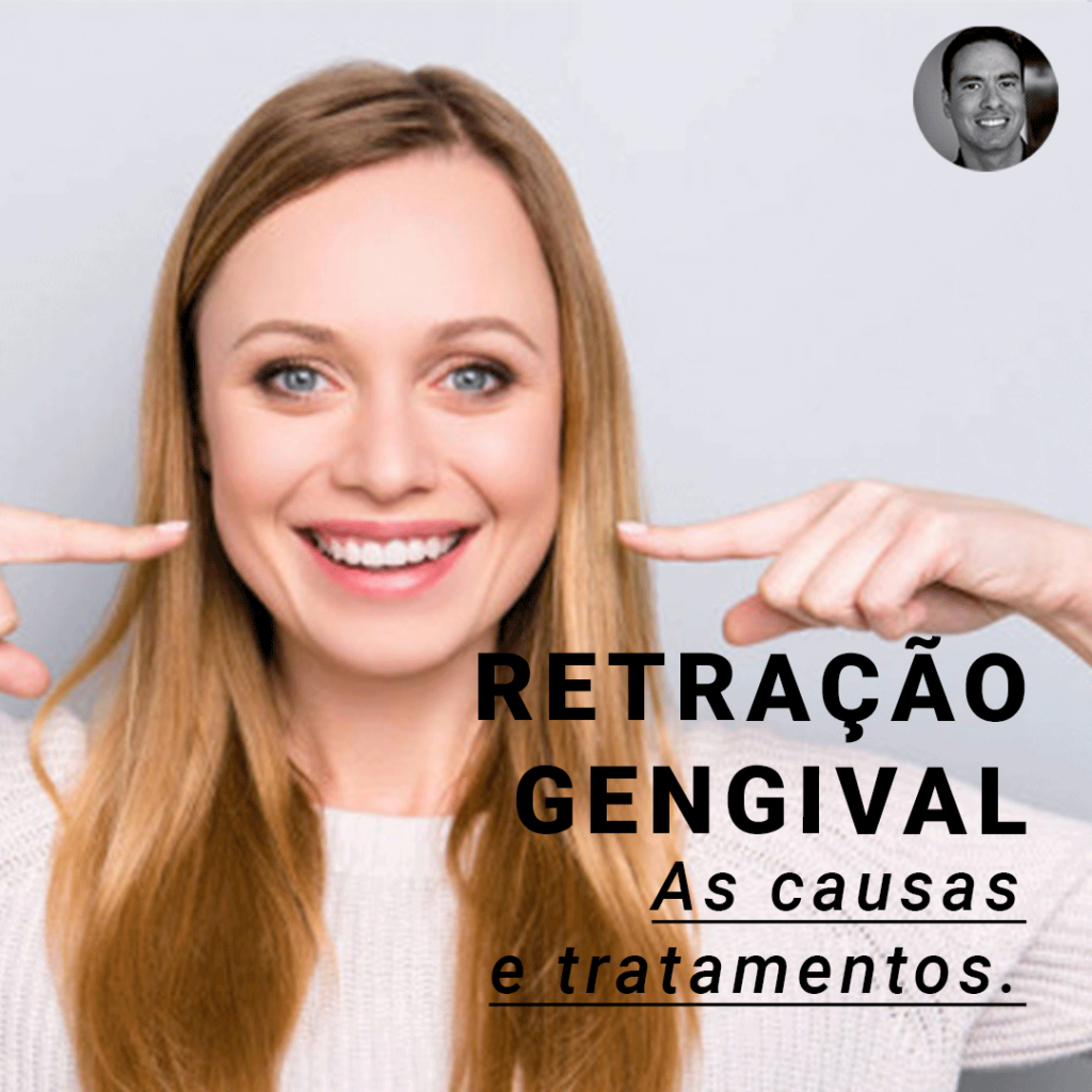instagram-carrossel-info-retração-#2_01