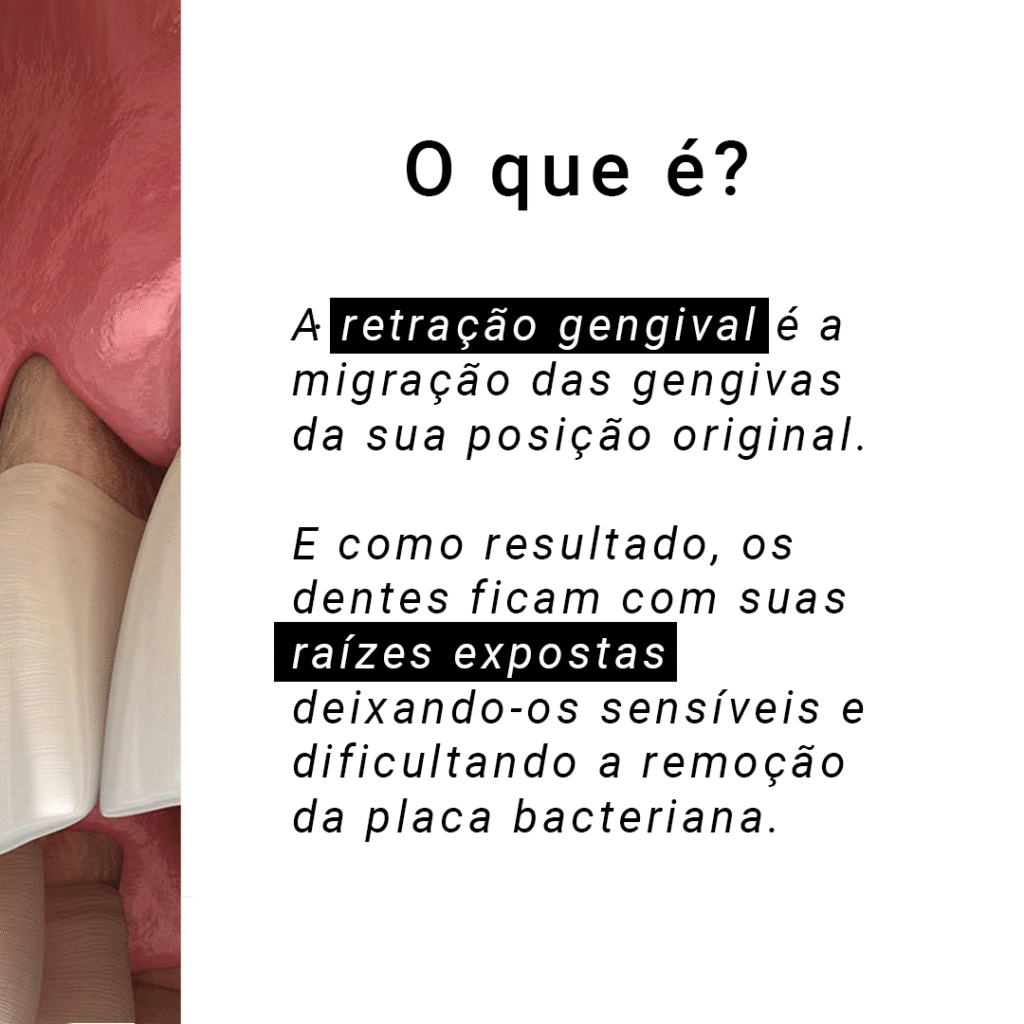 retracao-instagram-carrossel-10_02